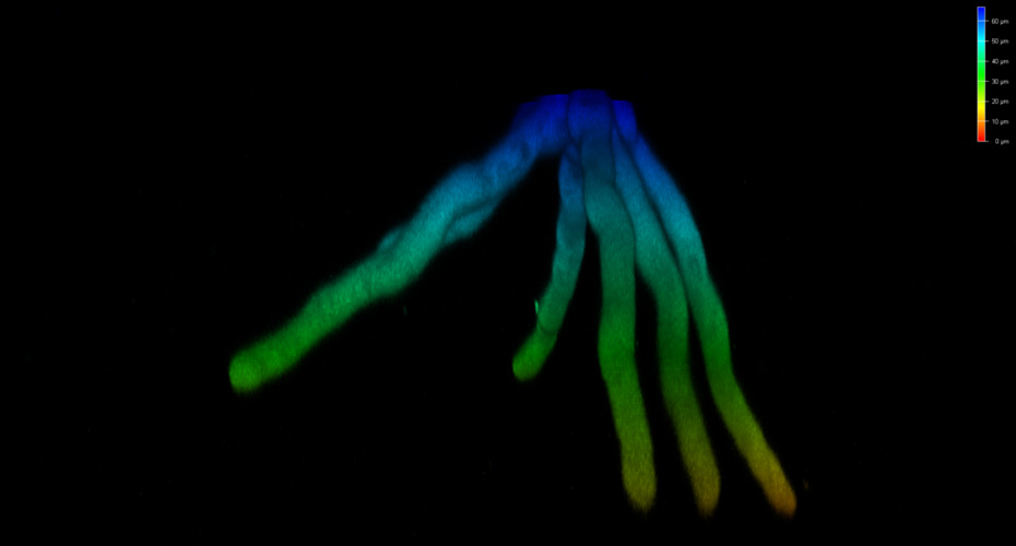 Invading Aspergillus fumigatus into agar