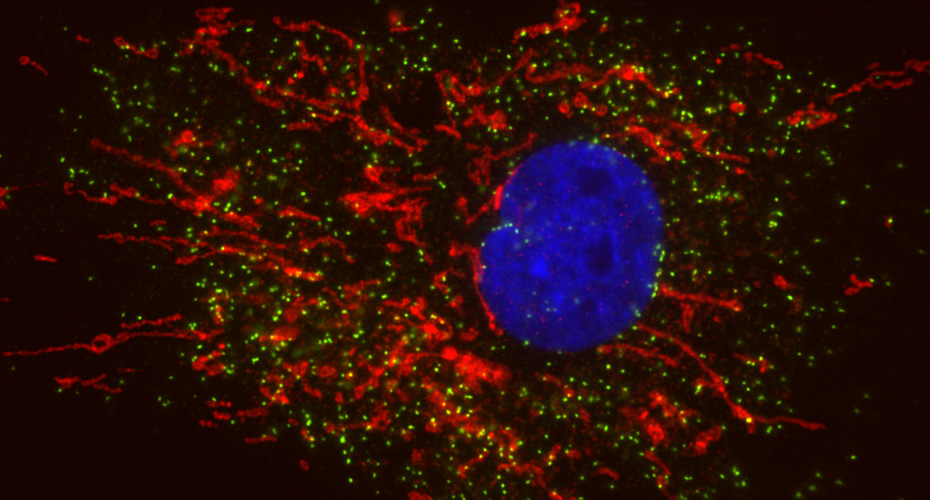 Organelles in a human fibroblast