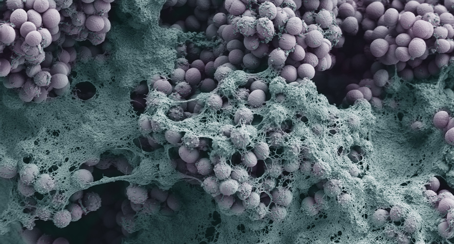False-coloured SEM of Staphylococcus epidermidis biofilms on stainless steel